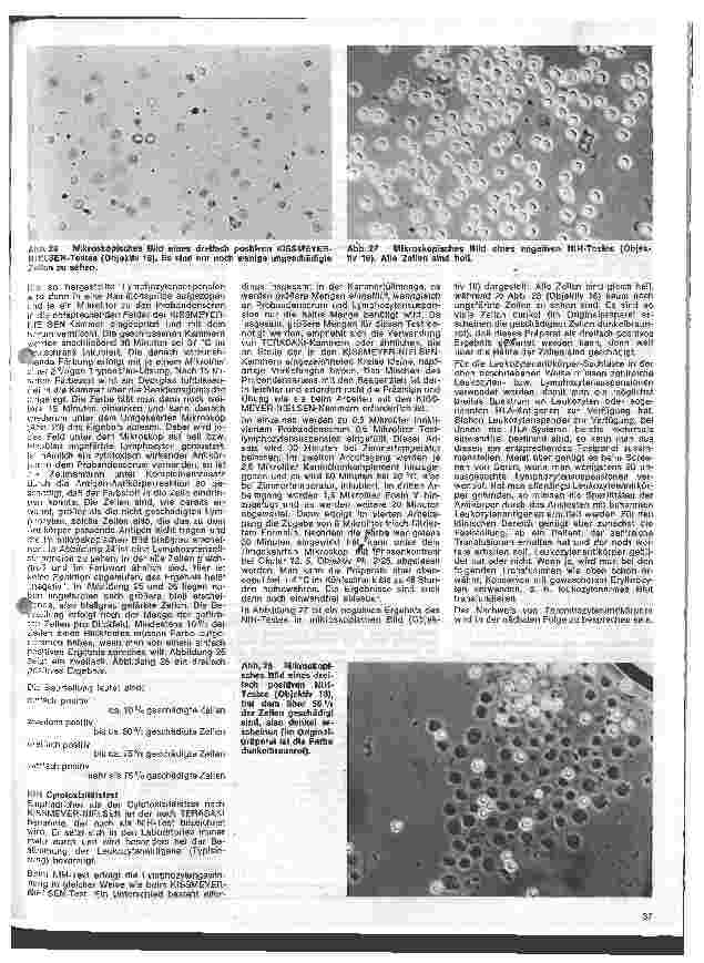 Vorschauseite 6: Transfusionskunde, Blutgruppenserologie und Immunhämatologie 22. Folge: Leukozytenantikörper