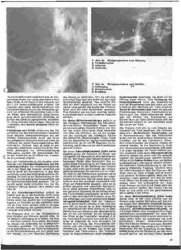 Vorschauseite 2: Einführung in die Hals - Nasen - Ohren - Heilkunde 4. Folge: Das Ohr Akute Erkrankungen des Mittelohres