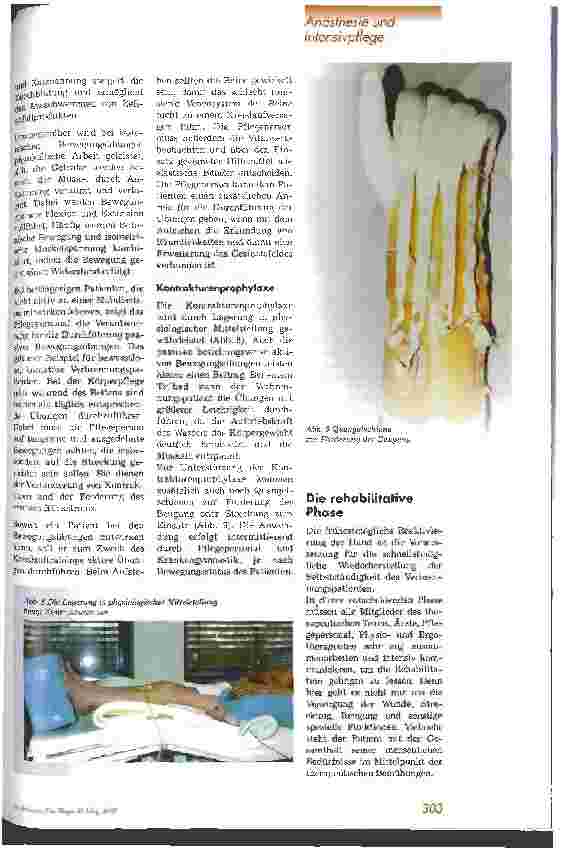 Vorschauseite 4: Frühförderung von Brandverletzten am Beispiel der verbrannten Hand