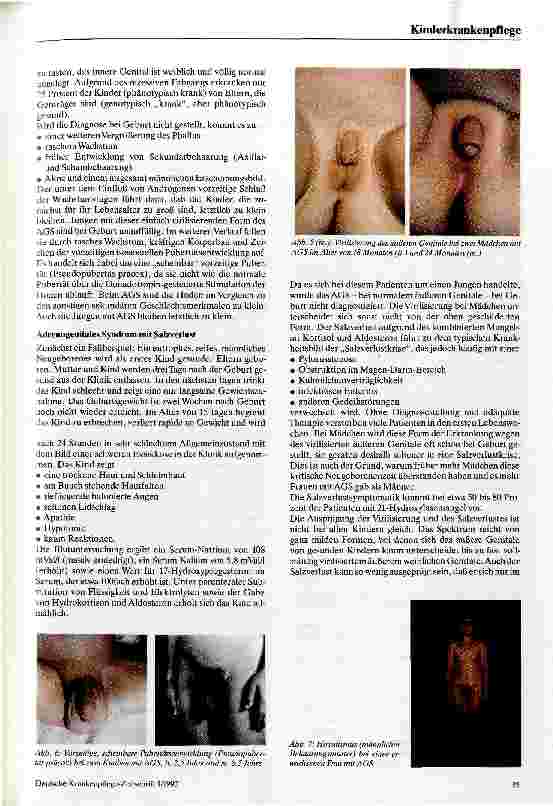 Vorschauseite 4: Das adrenogenitale Syndrom