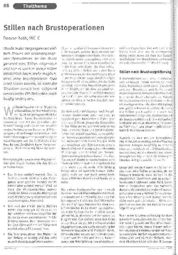 Vorschauseite 1: Stillen nach Brustoperationen