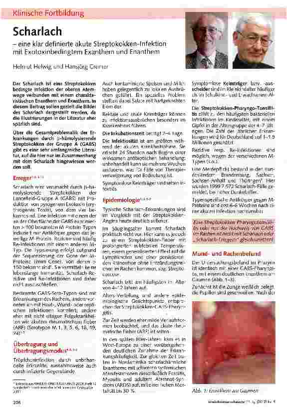 Vorschauseite 1: Scharlach - eine klar definierte akute Streptokokken-Infektion mit Exotoxinbedingtem Exanthem und Enanthem