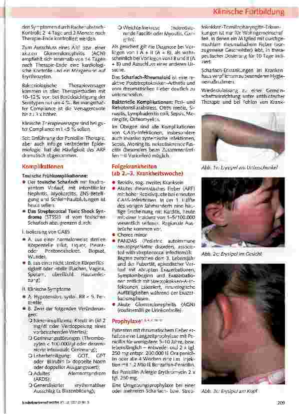 Vorschauseite 4: Scharlach - eine klar definierte akute Streptokokken-Infektion mit Exotoxinbedingtem Exanthem und Enanthem