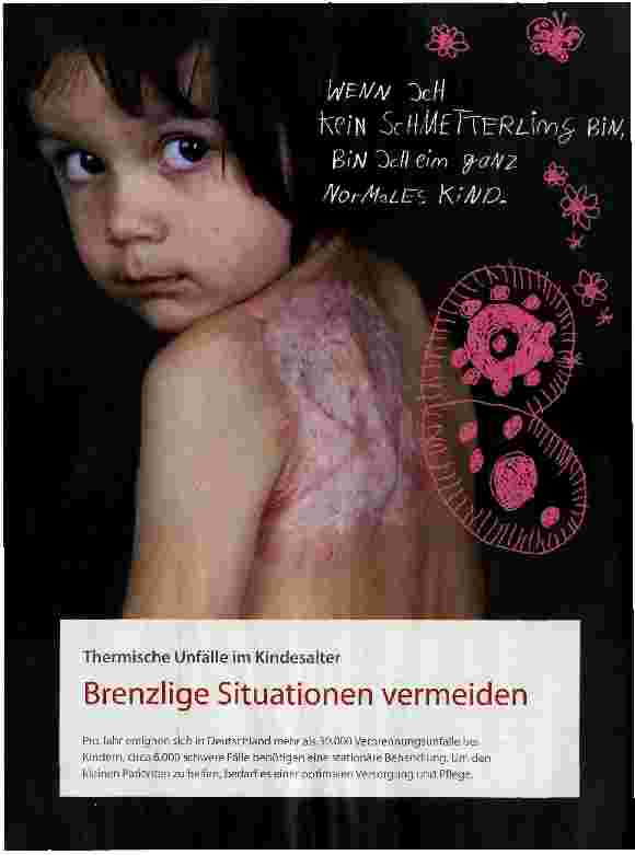Vorschauseite 1: Thermische Unfälle im KindesalterBrenzlige Situationen vermeiden