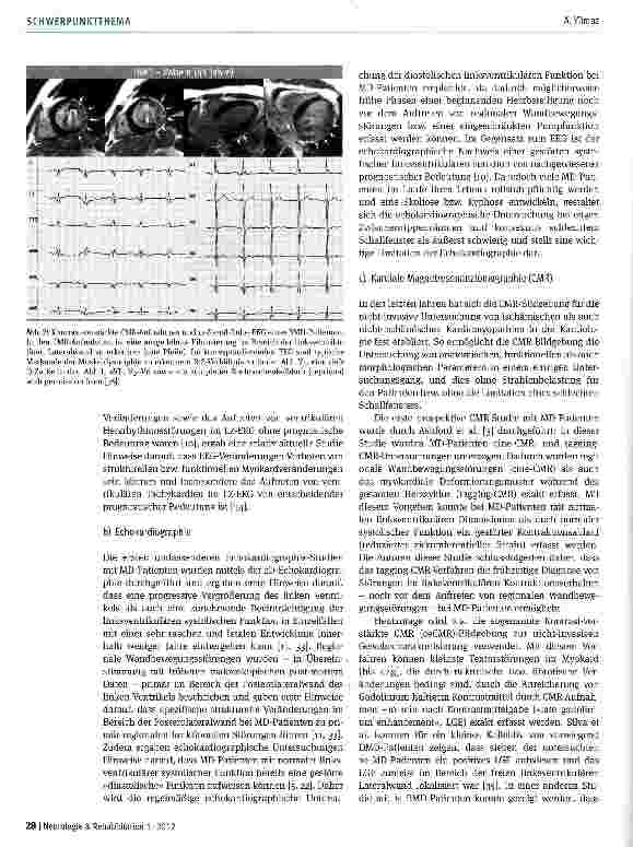 Vorschauseite 3: Herzerkrankungen bei Patienten mit Muskeldystrophie Typ Duchenne bzw. Becker - aktueller Stand der Diagnostik und der Therapie