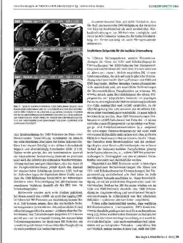 Vorschauseite 4: Herzerkrankungen bei Patienten mit Muskeldystrophie Typ Duchenne bzw. Becker - aktueller Stand der Diagnostik und der Therapie