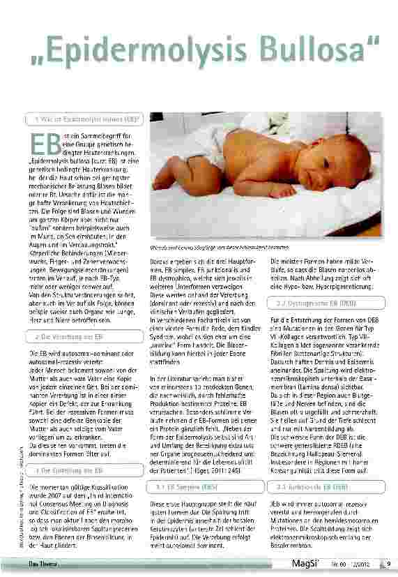 Vorschauseite 1: Epidermolysis Bullosa