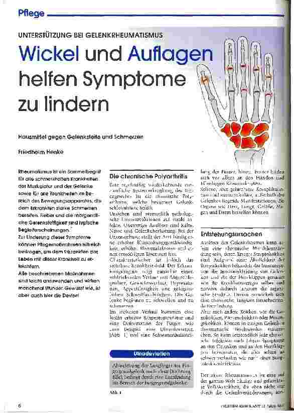 Vorschauseite 1: Wickel und Auflagen helfen Symptome zu lindern Unterstützung bei Gelenkrheumatismus