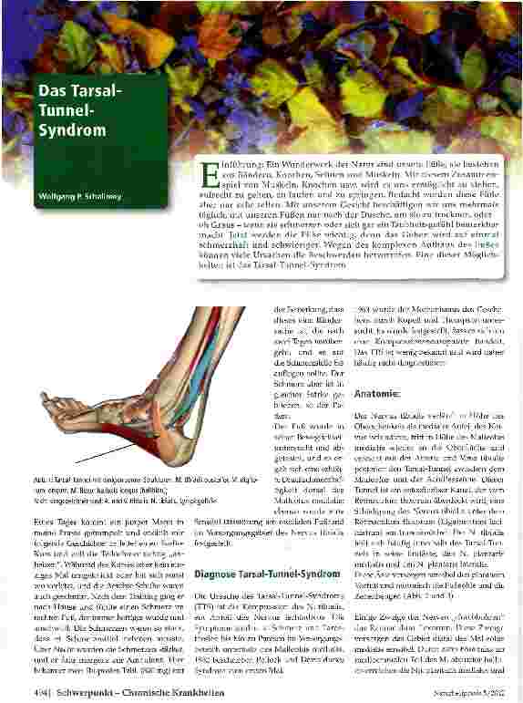 Vorschauseite 1: Das Tarsal-Tunnel-Syndrom