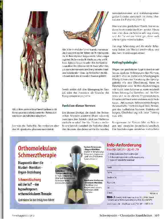 Vorschauseite 2: Das Tarsal-Tunnel-Syndrom