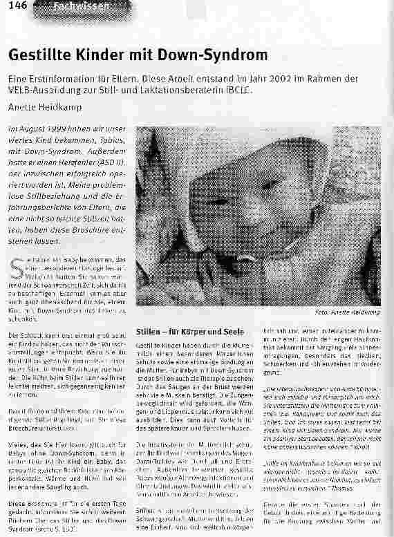 Vorschauseite 1: Gestillte Kinder mit Down-Syndrom