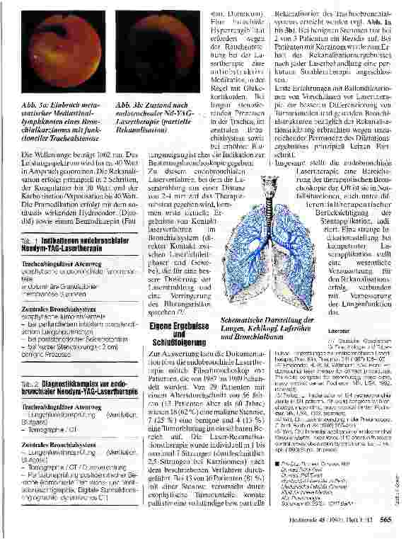 Vorschauseite 2: Lasertherapie Therapie in der Pneumologie
