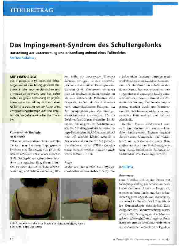 Vorschauseite 1: Das Impingement-Syndrom des Schultergelenks