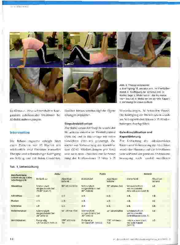 Vorschauseite 5: Das Impingement-Syndrom des Schultergelenks