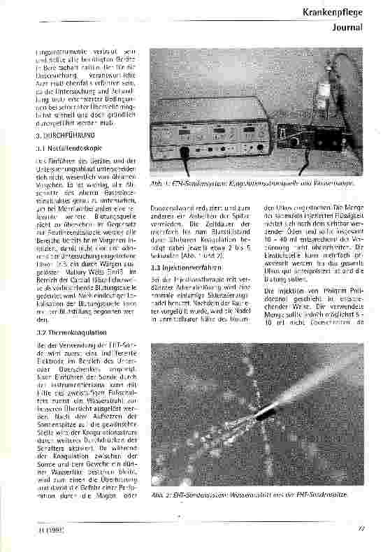 Vorschauseite 4: Endoskopische Stillungen von Ulcusblutungen Aus der 1.Med.Klinik der Friedrich-Alexander-Universität Erlangen