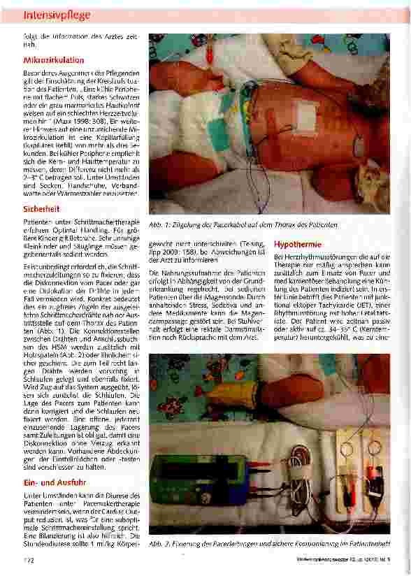 Vorschauseite 2: Pflege von Herzpatienten mit temporärem Schrittmacher