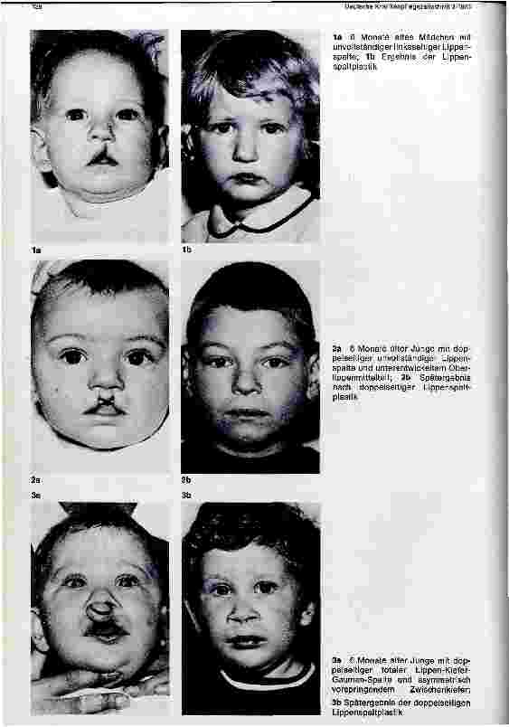 Vorschauseite 2: Der Tätigkeitsbereich einer Kinderkrankenschwester in der Mund-, Kieferund plastischen Gesichtschirurgie. ..