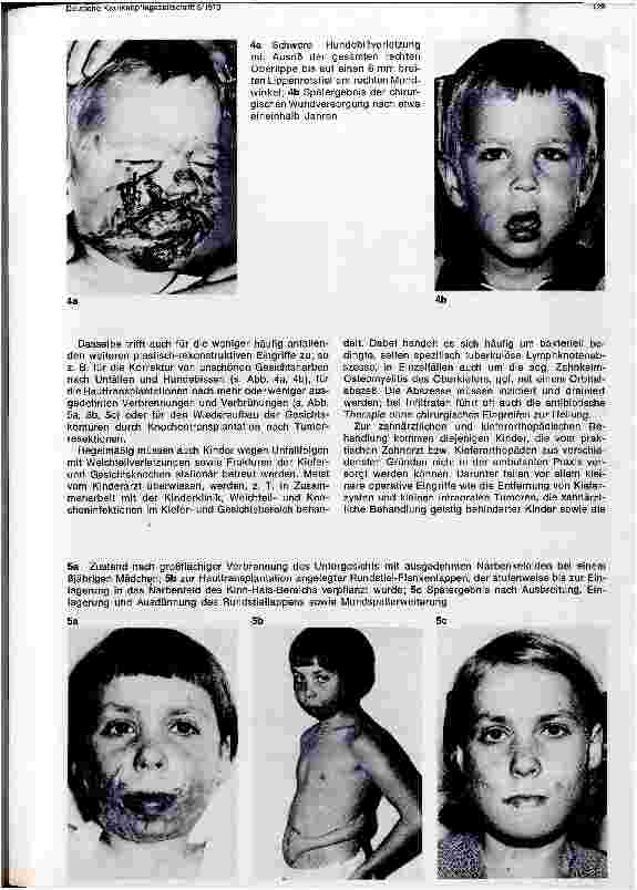 Vorschauseite 3: Der Tätigkeitsbereich einer Kinderkrankenschwester in der Mund-, Kieferund plastischen Gesichtschirurgie. ..