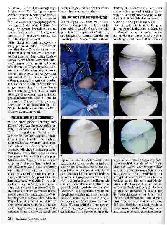 Vorschauseite 2: Arthroskopie bei Kniegelenkserkrankungen