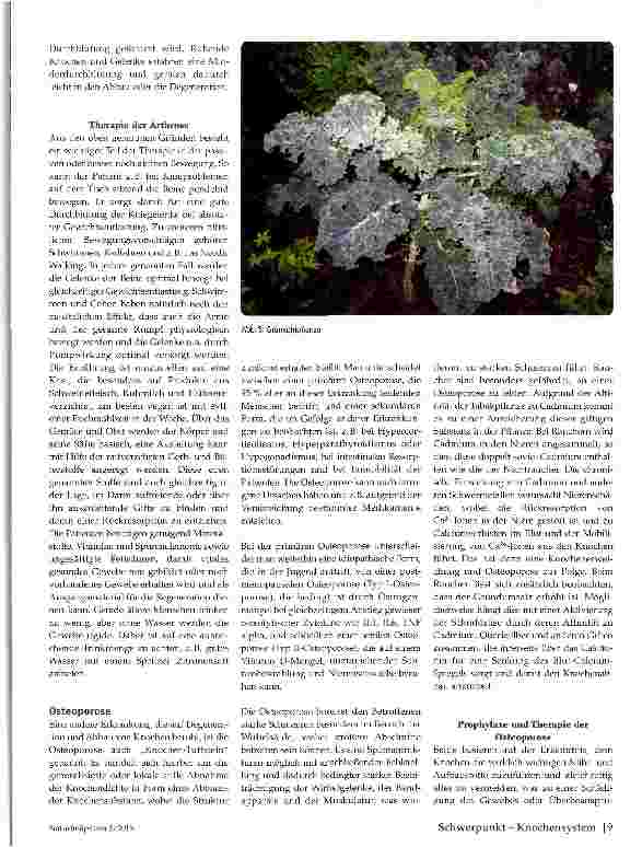 Vorschauseite 5: Therapiemöglichkeiten bei Knochenerkrankungen