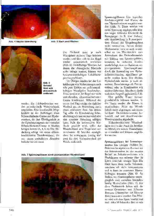Vorschauseite 3: BLASE IST NICHT GLEICH BLASE