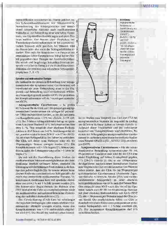 Vorschauseite 4: Diagnostik, Therapie und Nachsorge der extrakraniellen Carotisstenose