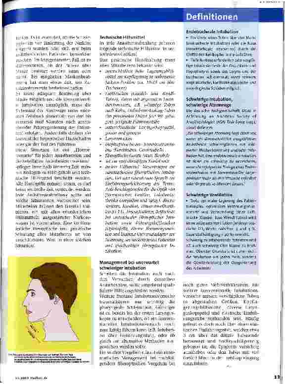 Vorschauseite 2: Die schwierige Intubation