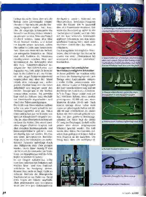 Vorschauseite 3: Die schwierige Intubation