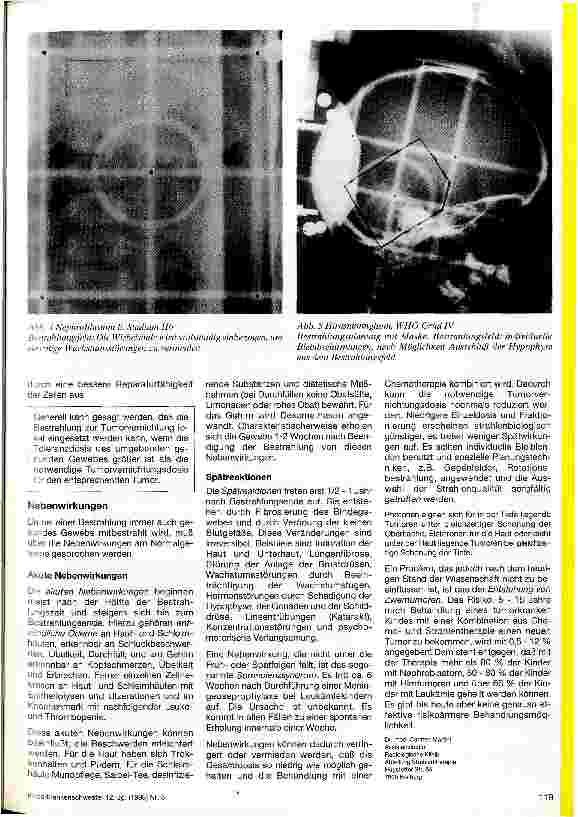 Vorschauseite 2: Strahlentherapie in der pädiatrischen Onkologie