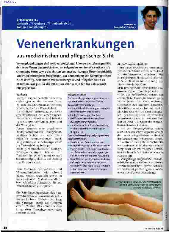 Vorschauseite 1: Venenerkrankungen aus medizinischer und pflegerischer Sicht