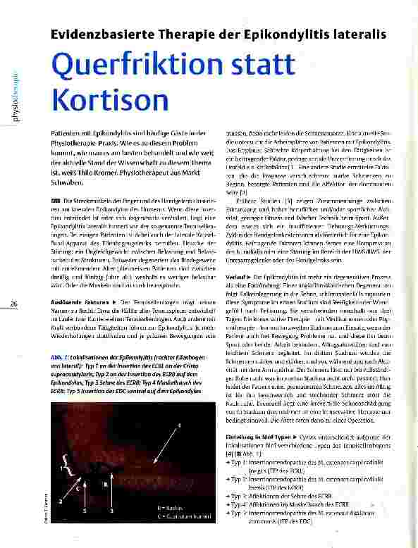Vorschauseite 1: Evidenzbasierte Therapie der Epikondylitis lateralis Querfriktion statt Kortison