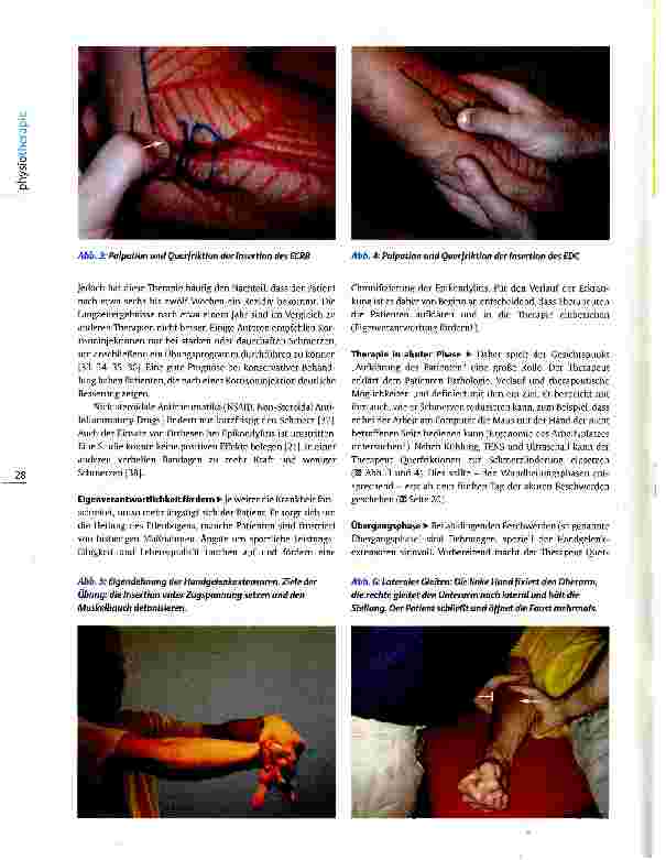 Vorschauseite 3: Evidenzbasierte Therapie der Epikondylitis lateralis Querfriktion statt Kortison