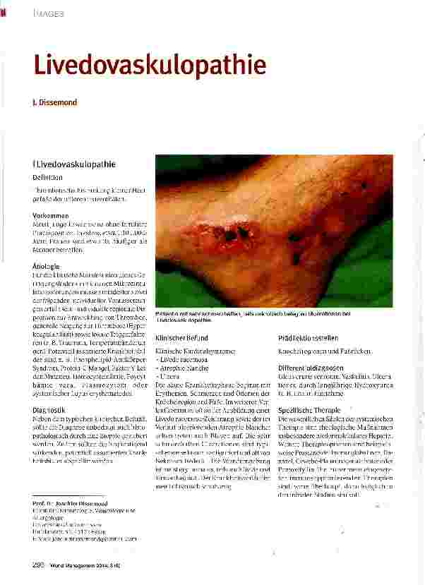 Vorschauseite 1: Livedovaskulopathie