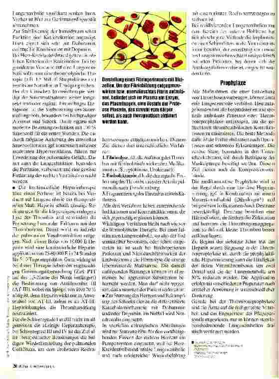 Vorschauseite 3: Lungenembolie Neue Aspekte der Diagnostik und Therapie