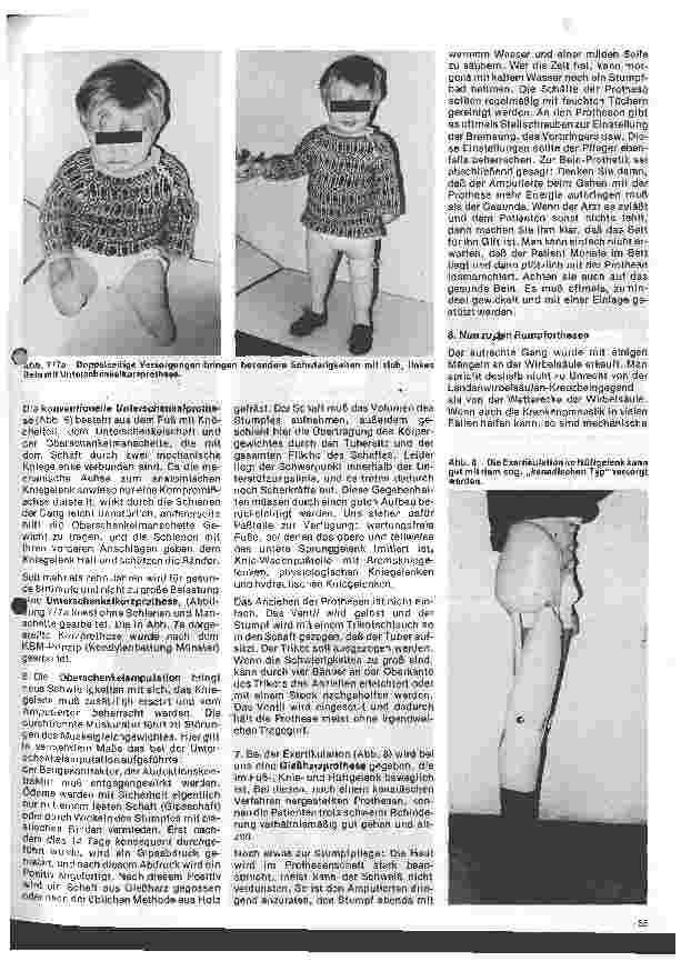 Vorschauseite 3: Grundformen moderner orthopädischer Apparate und Prothesen