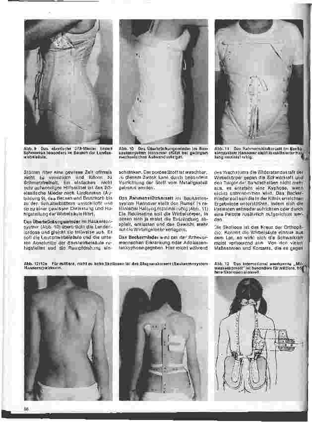 Vorschauseite 4: Grundformen moderner orthopädischer Apparate und Prothesen