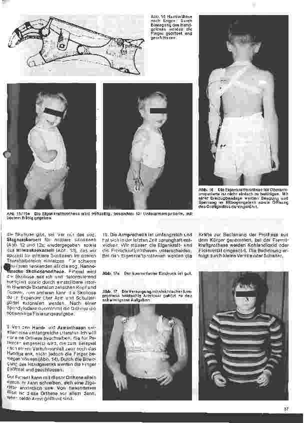 Vorschauseite 5: Grundformen moderner orthopädischer Apparate und Prothesen
