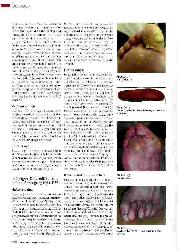 Vorschauseite 2: Orthopädieschuhtechnische Versorgung des Diabetes-Fuß-Syndroms