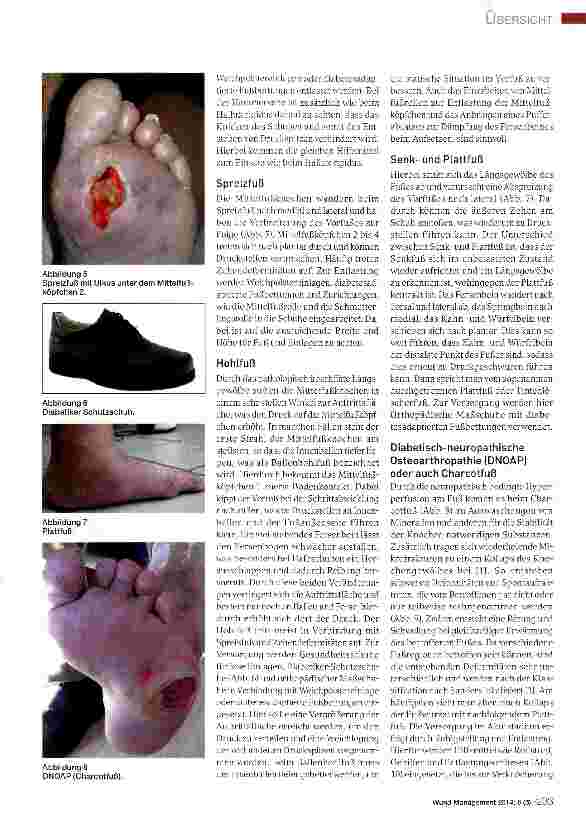 Vorschauseite 3: Orthopädieschuhtechnische Versorgung des Diabetes-Fuß-Syndroms