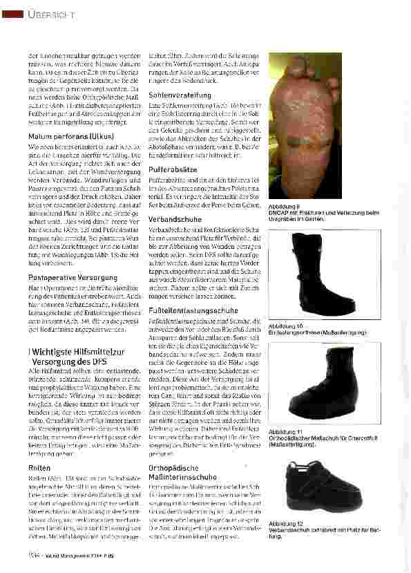 Vorschauseite 4: Orthopädieschuhtechnische Versorgung des Diabetes-Fuß-Syndroms