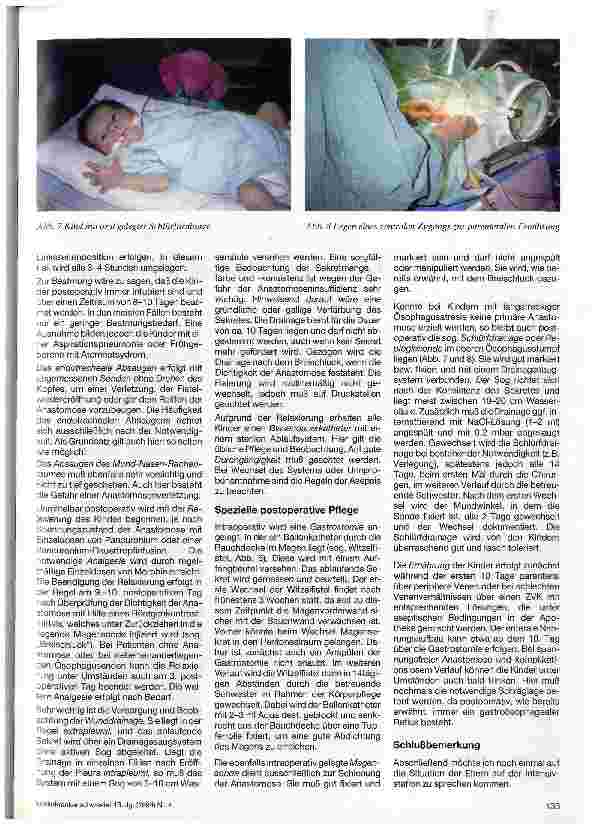 Vorschauseite 4: Die präund postoperative Pflege des Kindes mit Oesophagusatresie