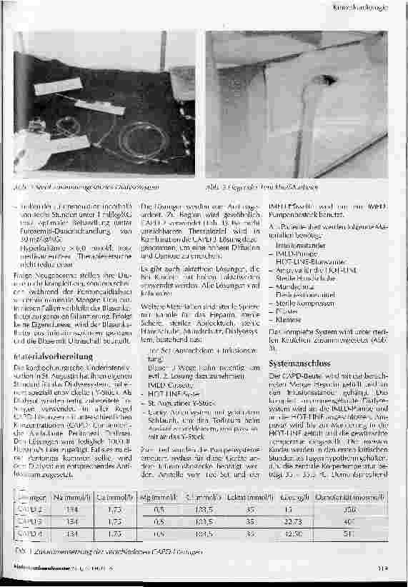 Vorschauseite 2: Peritonealdialyse nach kardiochirurgischen Operationen