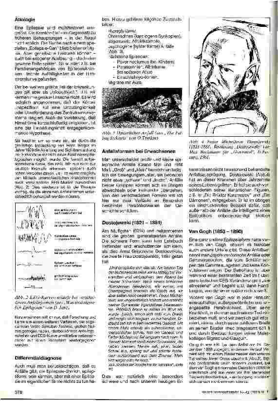 Vorschauseite 2: Über Epilepsie und deren Geschichte