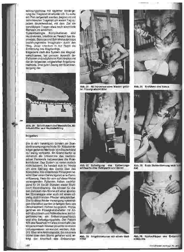 Vorschauseite 4: Stomaversorgung