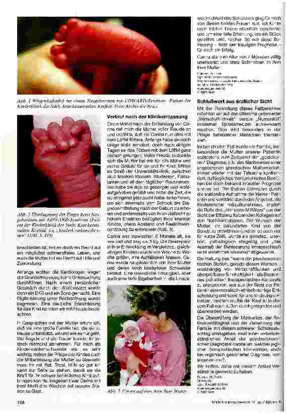 Vorschauseite 2: Psychosomatische Pflege und Betreuung bei Trisomie 18