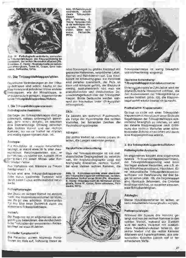 Vorschauseite 5: Das Herz 12.Folge: Erworbene Herzfehler, Klinik u. operative Therapie (II.Teil)