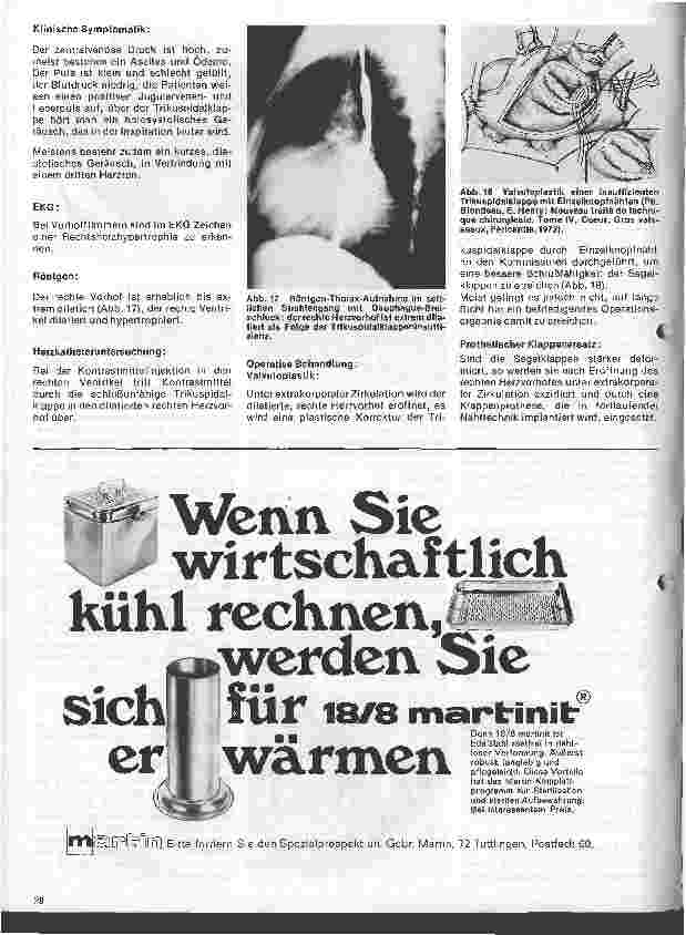 Vorschauseite 6: Das Herz 12.Folge: Erworbene Herzfehler, Klinik u. operative Therapie (II.Teil)