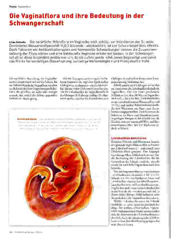 Vorschauseite 1: Die Vaginalflora und ihre Bedeutung in der Schwangerschaft