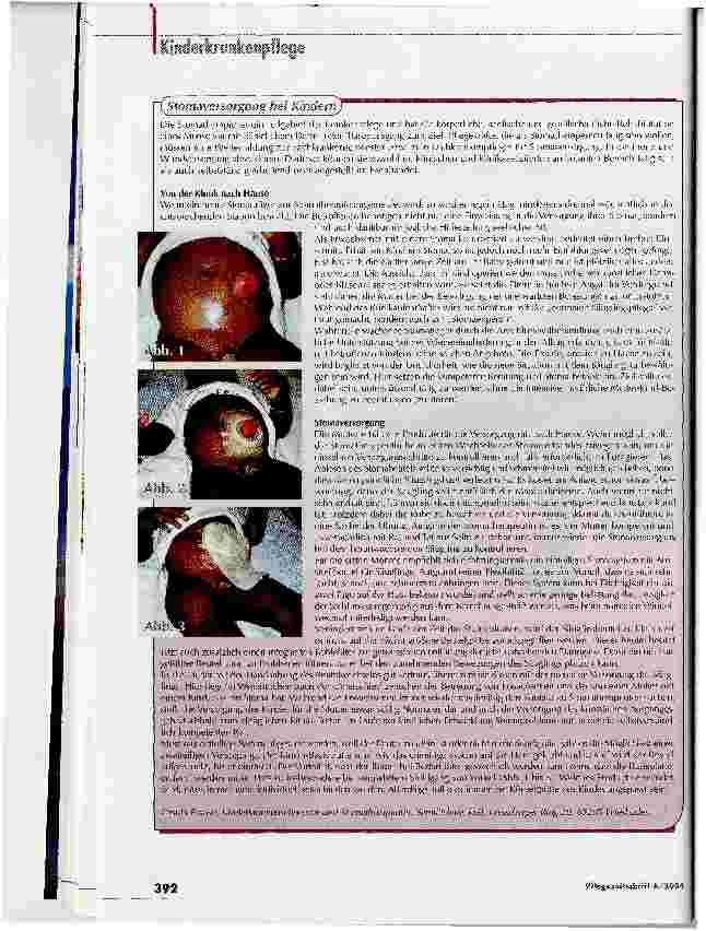 Vorschauseite 3: Eine Kindheit im Schatten der NormalitätLeben mit einem Stoma