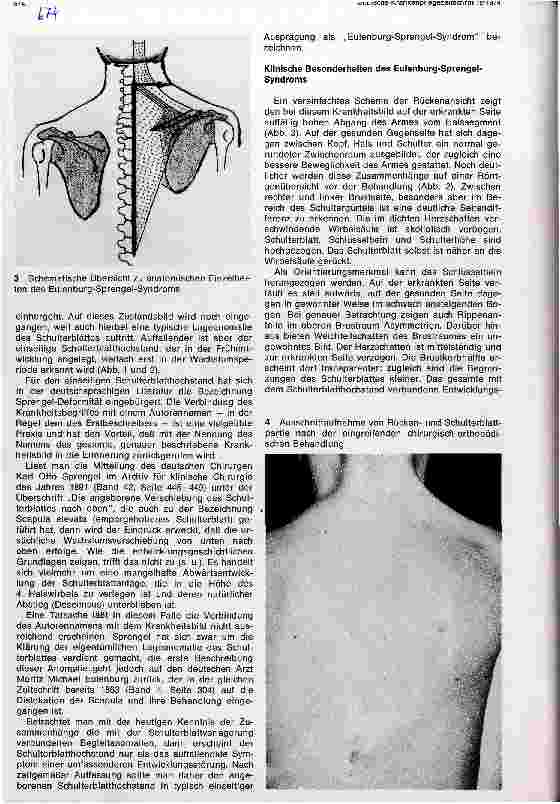 Vorschauseite 2: Anatomie und Therapie des angeborenen Schulterblatthochstandes